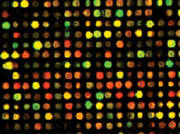 Image: Microarray assay result (Photo courtesy of Ashley Vance).